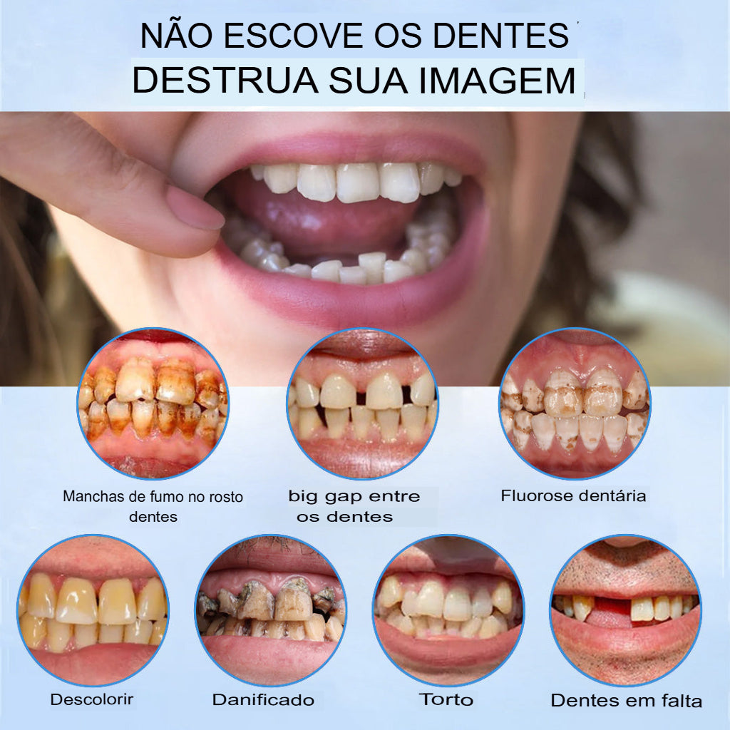 Sorriso Fácil ConfortDent™ 🦷 Prótese de Silicone Ajustável