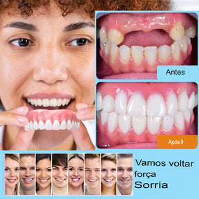 Sorriso Fácil ConfortDent™ 🦷 Prótese de Silicone Ajustável